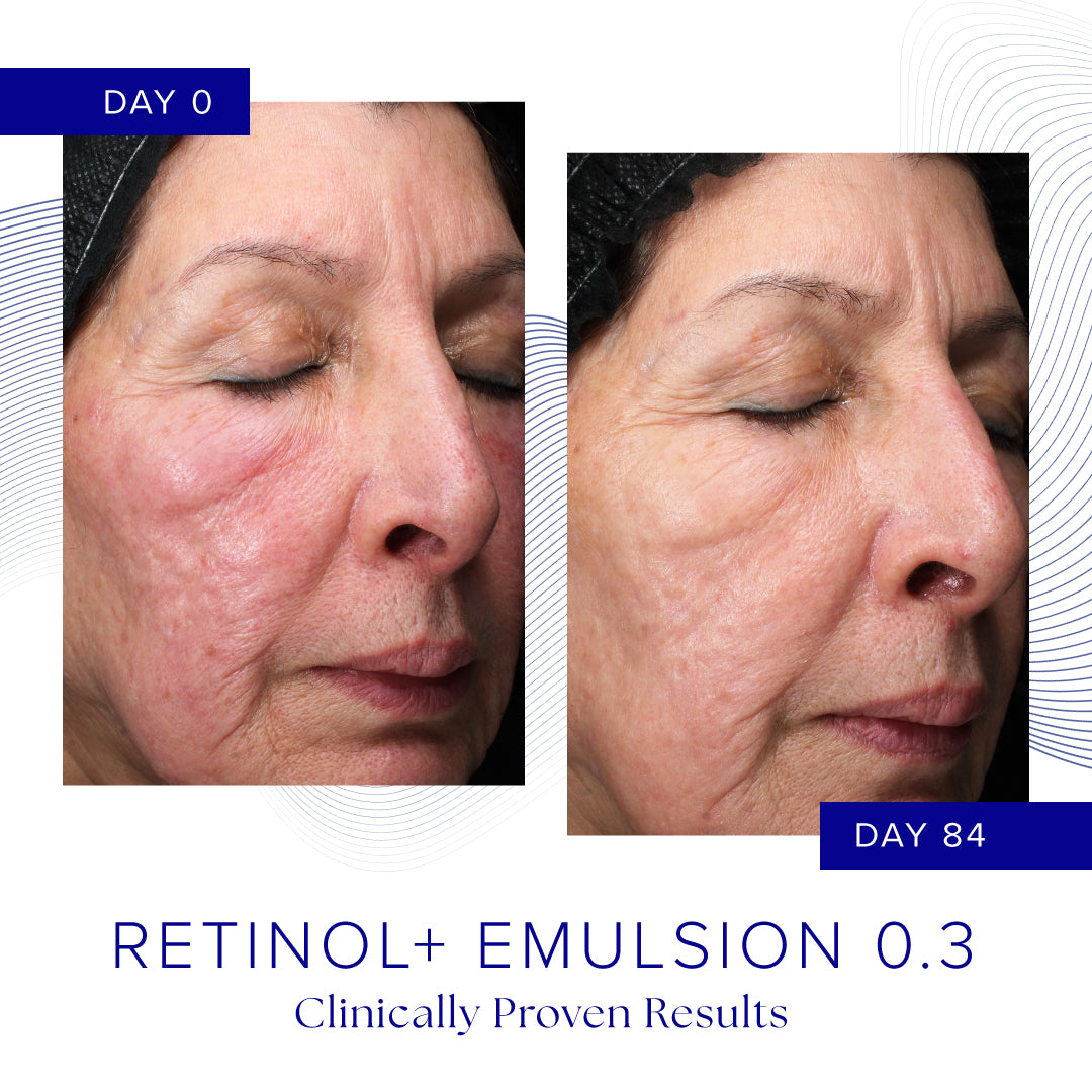 Retinol+ Emulsion 0.3 (30g)